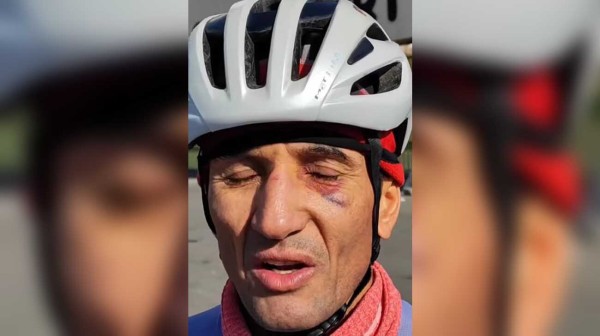 حمله دو راننده به حسین عسگری ملی پوش دوچرخه سواری در حین تمرین در جاده